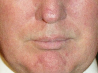 Illustration for article titled A Visual History of Donald Trump's Mouth